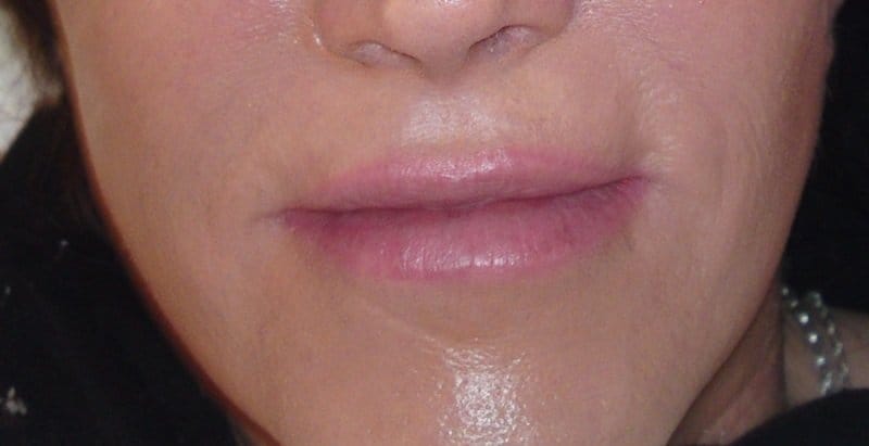 Lippenkorrektur Permanent Make up
