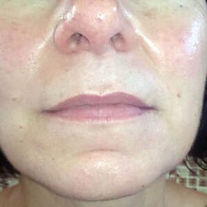 Lippenvergrößerung mit Permanent Make up